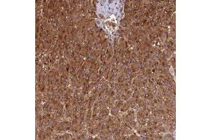 Immunohistochemical staining of human liver with DUS2L polyclonal antibody  shows strong cytoplasmic positivity in hepatocytes. (DUSL2 antibody)