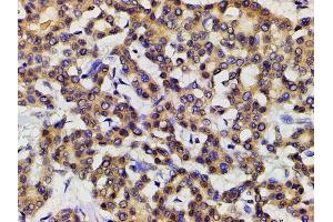 Immunohistochemistry (IHC) image for anti-Ephrin B2 (EFNB2) (C-Term) antibody (ABIN6261455)
