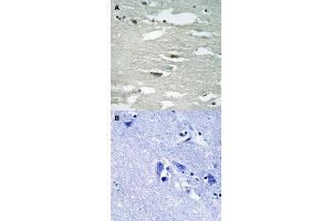 Immunohistochemical staining (Formalin-fixed paraffin-embedded sections) of human brain tissue with ILK (phospho S246) polyclonal antibody  without blocking peptide (A) or preincubated with blocking peptide (B) under 1:50-1:100 dilution. (ILK antibody  (pSer246))
