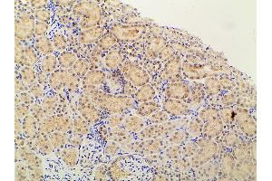ABIN6267452 at 1/100 staining rat kidney tissue sections by IHC-P. (PIK3R1 antibody  (pTyr607))
