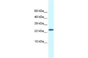 WB Suggested Anti-Csdc2 Antibody   Titration: 1. (CSDC2 antibody  (Middle Region))