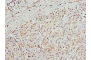 Immunohistochemistry of paraffin-embedded human pancreatic tissue using ABIN7154163 at dilution of 1:100 (GPD2 antibody  (AA 25-325))
