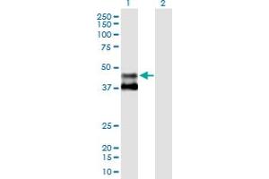Western Blot analysis of MMAA expression in transfected 293T cell line by MMAA MaxPab polyclonal antibody. (MMAA antibody  (AA 1-418))