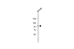 Anti-PROX-1- Antibody at 1:2000 dilution + mouse liver lysate Lysates/proteins at 20 μg per lane. (PROX1 antibody  (AA 492-520))