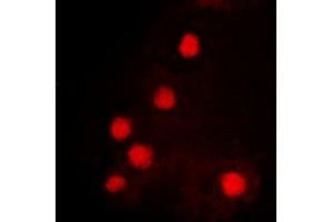 Immunofluorescent analysis of HOXC6 staining in K562 cells. (Homeobox C6 antibody  (C-Term))