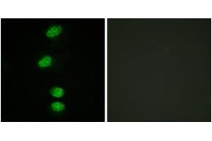 Immunofluorescence analysis of HeLa cells, using Androgen Receptor (Phospho-Ser94) Antibody. (Androgen Receptor antibody  (pSer94))