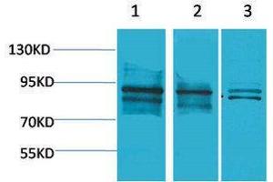 Western Blotting (WB) image for anti-Aryl Hydrocarbon Receptor Nuclear Translocator (ARNT) antibody (ABIN3181520) (ARNT antibody)