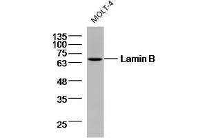 MOLT-4 cell lysates probed with Lamin B (9C11) Monoclonal Antibody, unconjugated (bsm-33040M) at 1:300 overnight at 4°C followed by a conjugated secondary antibody for 60 minutes at 37°C. (Lamin B antibody)