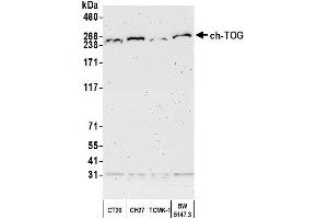 Western Blotting (WB) image for anti-Cytoskeleton Associated Protein 5 (CKAP5) (AA 1982-2032) antibody (ABIN7450111)