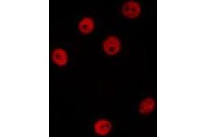 ABIN6277208 staining Hela by IF/ICC.