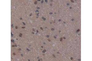 IHC-P analysis of Human Tissue, with DAB staining. (REPIN1 antibody  (AA 57-314))