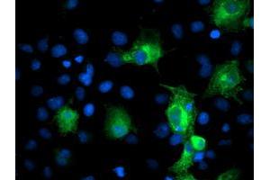 Anti-PFKP mouse monoclonal antibody (ABIN2455337) immunofluorescent staining of COS7 cells transiently transfected by pCMV6-ENTRY PFKP (RC200673). (PFKP antibody)