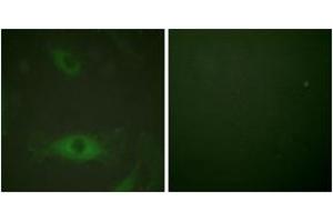 Immunofluorescence analysis of HeLa cells treated with TNF-a 20nM 15', using c-PLA2 (Phospho-Ser505) Antibody. (C-PLA2 (AA 471-520), (pSer505) antibody)