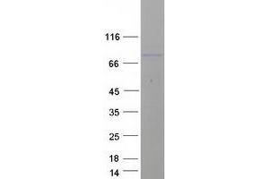 Western Blotting (WB) image for Homolog of Yeast RecQ-mediated Genome Instability 1 (RMI1) protein (Myc-DYKDDDDK Tag) (ABIN2730977)
