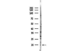 anti-Refilin-B (RFLNB) antibody