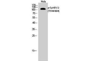 Western Blotting (WB) image for anti-EPH Receptor B1/2 (EPHB1/2) (pTyr594), (pTyr604) antibody (ABIN3173176) (EPHB1/2 antibody  (pTyr594, pTyr604))