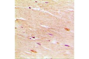 Immunohistochemical analysis of SERCA1 staining in human muscle formalin fixed paraffin embedded tissue section.