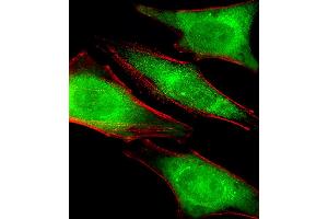 Fluorescent image of Hela cells stained with PRS4 Antibody . (PSMC1 antibody  (C-Term))