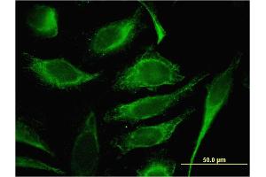 Immunofluorescence of monoclonal antibody to TMSB4Y on HeLa cell. (TMSB4Y antibody  (AA 1-44))