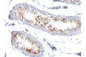 Formalin-fixed, paraffin-embedded human Testis stained with Melan-A / MART-1 Mouse Monoclonal Antibody (MLANA/788). (MLANA antibody)