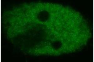 Confocal microscopy of human HeLa cells using anti-p53 (BP53-12 ; FITC). (p53 antibody)