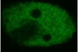 Confocal microscopy of human HeLa cells using anti-p53 (BP53-12 ; FITC). (p53 antibody)
