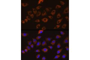 Immunofluorescence analysis of L929 cells using DLG1 Rabbit pAb (ABIN6130273, ABIN6139646, ABIN6139648 and ABIN6224636) at dilution of 1:100 (40x lens). (DLG1 antibody  (AA 1-190))