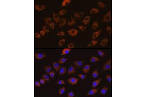 Immunofluorescence analysis of L929 cells using DLG1 Rabbit pAb (ABIN6130273, ABIN6139646, ABIN6139648 and ABIN6224636) at dilution of 1:100 (40x lens). (DLG1 antibody  (AA 1-190))