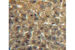 #VALUE! (CCL3 antibody  (AA 24-92))
