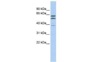 Beta Tubulin 2A antibody used at 1 ug/ml to detect target protein. (beta Tubulin 2A (N-Term) antibody)