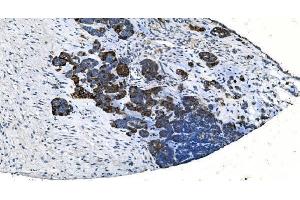 IHC analysis of TMPRSS3 using anti-TMPRSS3 antibody (ABIN7601198).