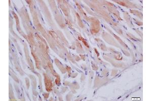 Formalin-fixed and paraffin embedded mouse stomach muscle labeled with Anti-HSPB7 Polyclonal Antibody, Unconjugated (ABIN1387071) at 1:200 followed by conjugation to the secondary antibody and DAB staining (HSPB7 antibody  (AA 135-170))