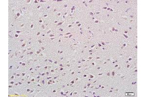 Formalin-fixed and paraffin embedded rat brain labeled with Anti-COX 5B Polyclonal Antibody, Unconjugated (ABIN751318) at 1:200 followed by conjugation to the secondary antibody and DAB staining (COX5B antibody  (AA 21-120))