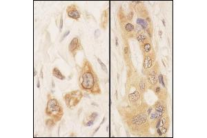 Immunohistochemistry (IHC) image for anti-serine threonine Kinase 39 (STK39) (AA 375-425) antibody (ABIN7453840) (STK39 antibody  (AA 375-425))
