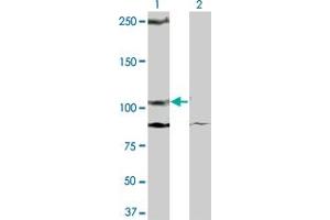 Western Blot analysis of KIT expression in transfected 293T cell line by KIT monoclonal antibody (M08), clone 2C3. (KIT antibody  (AA 41-140))