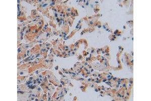 IHC-P analysis of Kidney tissue, with DAB staining. (TNFAIP3 antibody  (AA 1-300))