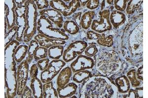 ABIN6274024 at 1/100 staining Rat kidney tissue by IHC-P. (MHC, Class I antibody)