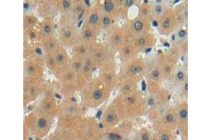 Used in DAB staining on fromalin fixed paraffin-embedded liver tissue (LECT2 antibody  (AA 1-151))