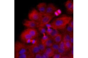 Immunofluorescenitrocellulosee of HaCaT cells stained with Hoechst 3342 (Blue) for nucleus staining and monoclonal anti-human beta-Tubulin antibody (1:1000) with Texas Red (Red). (TUBB antibody  (AA 1-445))