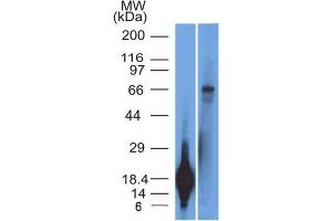 Western Blot Analysis of TRIM29 Recombinant protein fragment & A431 cell lysate TRIM29 Monoclonal Antibody (TRIM29/1042). (TRIM29 antibody  (AA 1-200))