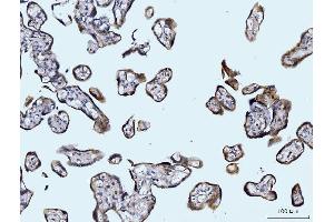 IHC analysis of Glutaminase/GLS using anti-Glutaminase/GLS antibody (ABIN7601602). (Glutaminase antibody  (AA 396-654))