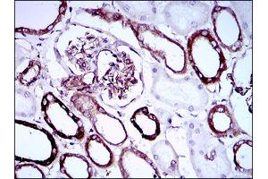 Immunohistochemistry (IHC) image for anti-Synaptonemal Complex Protein 3 (SYCP3) (AA 27-128) antibody (ABIN1724891)