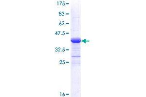 Image no. 1 for Transforming Growth Factor, beta Receptor II (70/80kDa) (TGFBR2) (AA 62-165) protein (GST tag) (ABIN1322615) (TGFBR2 Protein (AA 62-165) (GST tag))