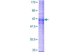 SDS-PAGE (SDS) image for Chemokine (C-X3-C Motif) Receptor 1 (CX3CR1) (AA 1-355) protein (GST tag) (ABIN1777380)