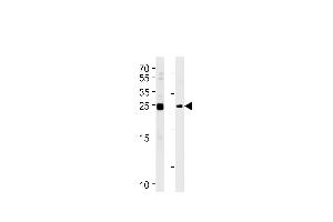 MOB4A Antibody (C-term) (ABIN391030 and ABIN2841198) western blot analysis in Daudi,K562 cell line lysates (35 μg/lane).