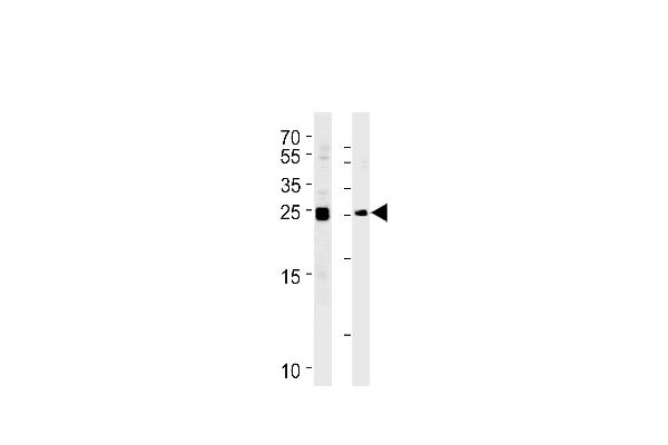 MOBKL1A Antikörper  (C-Term)