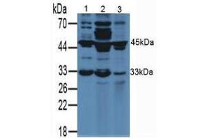 Western blot analysis of (1) Rat Breast Tissue, (2) Rat Placenta Tissue and (3) Rat Lung Tissue. (VEGFA antibody  (AA 27-190))