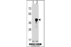 Western blot analysis of C4BPB using rabbit polyclonal C4BPB Antibody using 293 cell lysates (2 ug/lane) either nontransfected (Lane 1) or transiently transfected (Lane 2) with the C4BPB gene.