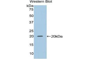 Detection of Recombinant NME2, Mouse using Polyclonal Antibody to Non Metastatic Cells 2, Protein NM23B Expressed In (NME2) (NME2 antibody  (AA 8-149))