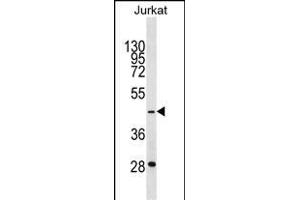 GTF3A Antibody (C-term) (ABIN1537104 and ABIN2850137) western blot analysis in Jurkat cell line lysates (35 μg/lane). (GTF3A antibody  (C-Term))